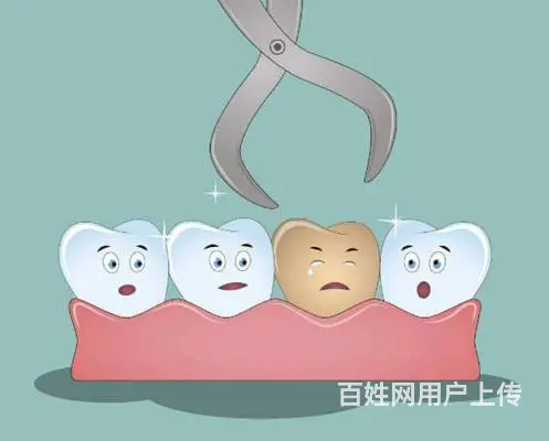 拔牙需要注意什么 哈尔滨拔牙好的诊所 - 图片 1
