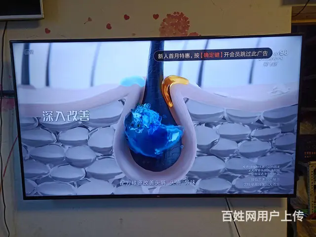 【搞定了！】小米电视 - 图片 3