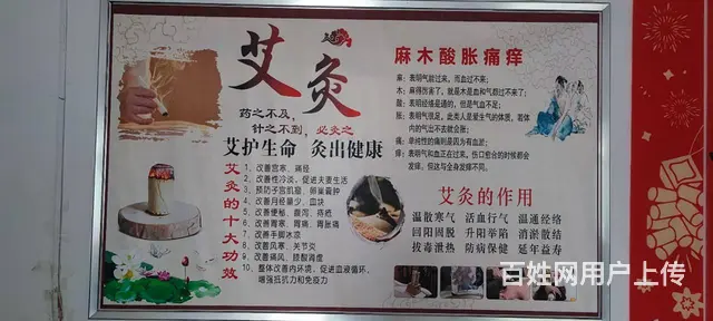 艾灸中医治疗 - 图片 1