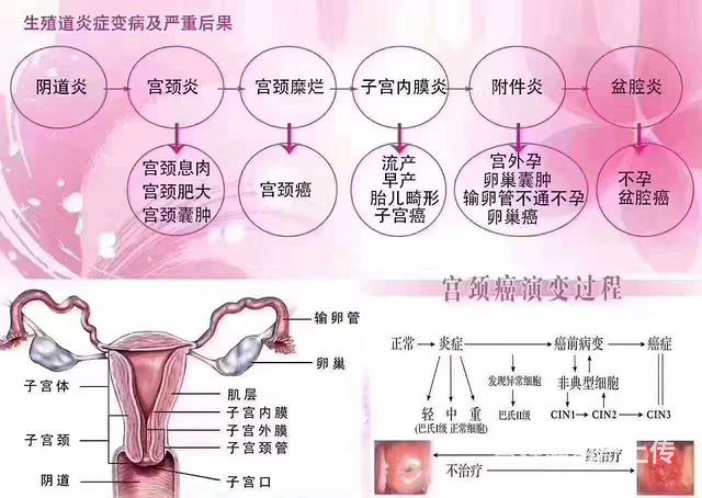 幽诺女神调理妇科效果好吗