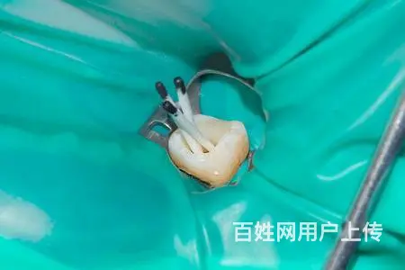哈尔滨根管  的专科医院 - 图片 2