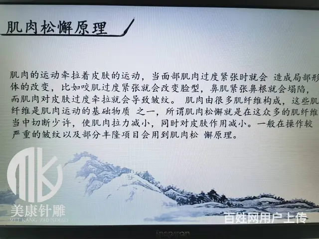 南京针雕针灸美雕 提升公益课领取中 - 图片 3