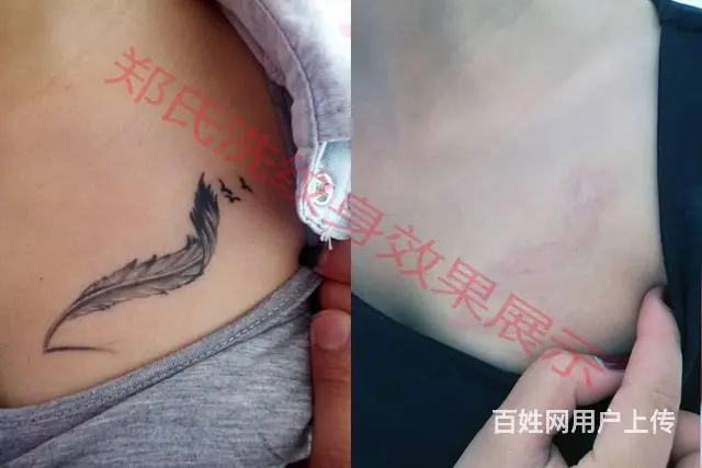 沈阳洗纹身一次性洗净纹身郑氏洗纹身包洗干净所有纹身 - 图片 5