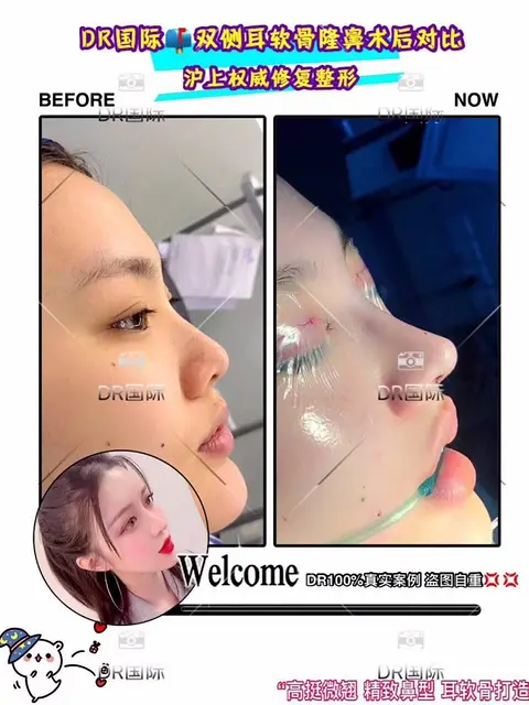 整形咨询顾问培训班零基础培训班 - 图片