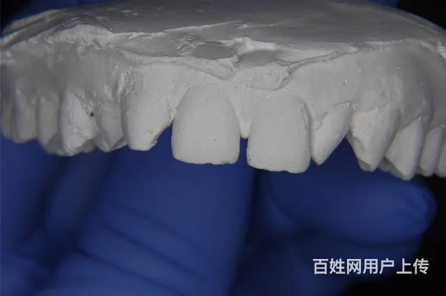 哈尔滨镶牙那个诊所比较好 - 图片 1