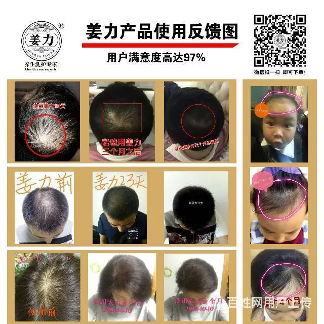 生姜洗发水无硅油去油去屑防脱生发 - 图片 11