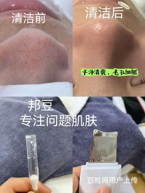 美容护肤 - 图片 5