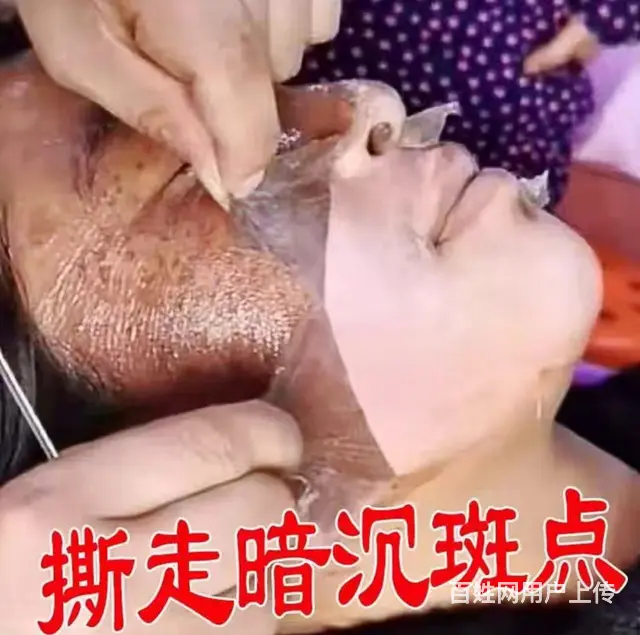 祛斑祛痘诚邀加盟 - 图片 2