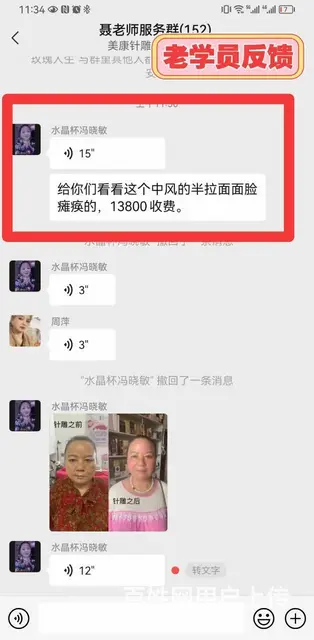 石家庄针灸美雕培训哪里好 - 图片 2
