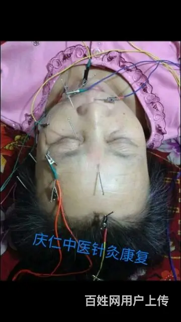 执业中医上门针灸推拿康复 - 图片 3
