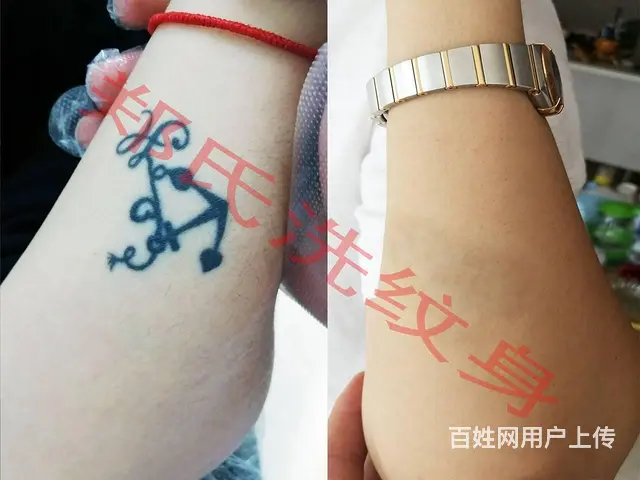 怎样选择洗纹身店可靠 - 图片 1
