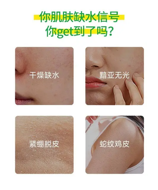 小蜜缇牛油果维E乳霜批发代理 - 图片 3