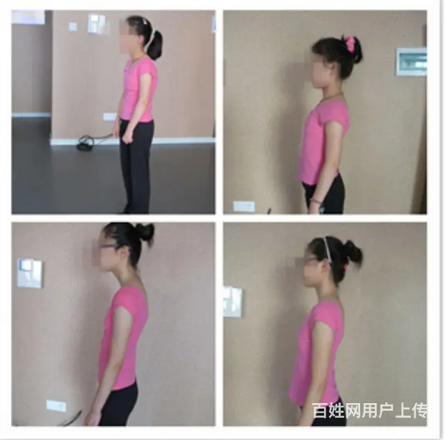 形体训练  矫正驼背 走姿 八字脚 - 图片 2