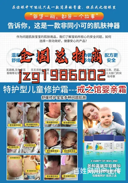 戒之馆婴儿护臀膏 宝宝“红臀”无所畏 - 图片 2