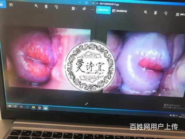 吉林市私密疗愈全国免费培训 - 图片 2