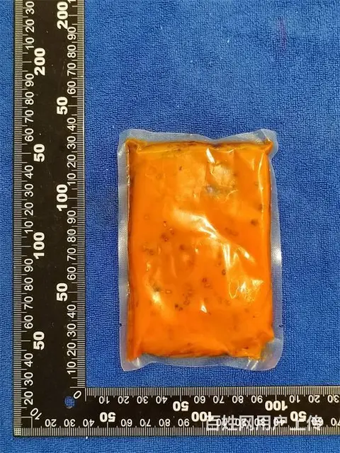 红烧肉香辛料配方剖析、成分分析、原料鉴定 - 图片