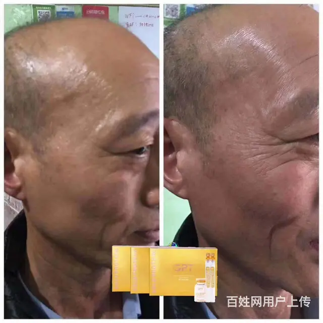 gpt黄金线雕全国招商 - 图片 3