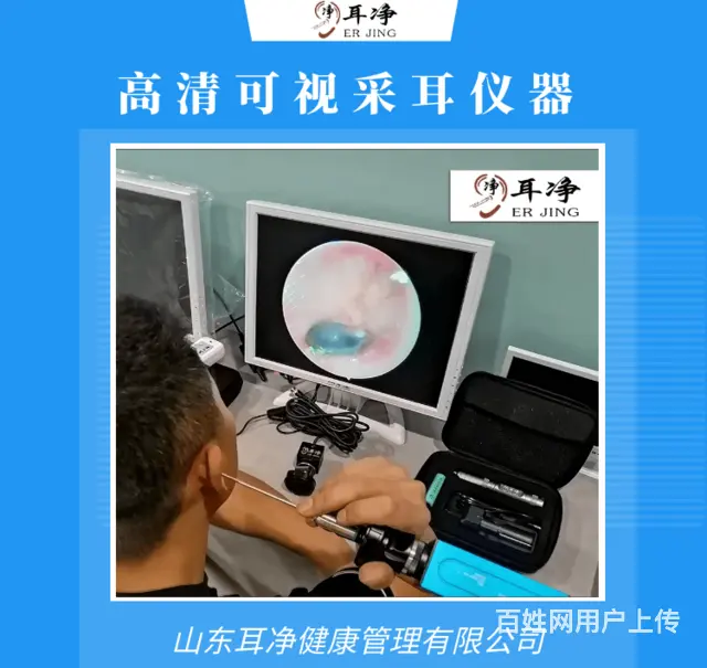 九江智能高清可视采耳仪器设备口碑好不好 - 图片 2